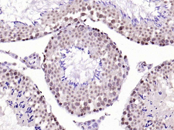 BLM Rabbit Polyclonal Antibody