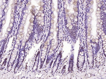 BLM Rabbit Polyclonal Antibody