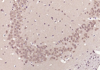 PAK1 (phospho-Ser204) antibody