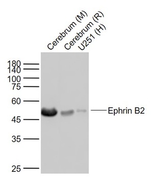 Ephrin B2 antibody