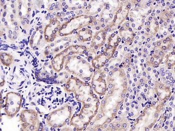 Cytochrome P450 17A1 antibody