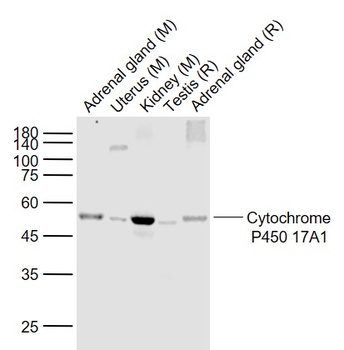 Cytochrome P450 17A1 antibody