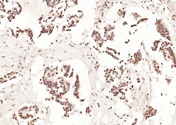 CDKN1A antibody