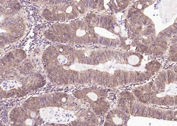 HSC70 Mouse Monoclonal Antibody