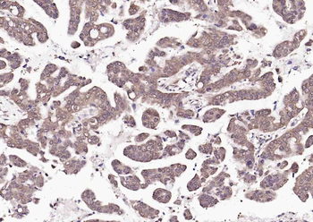 HSC70 Mouse Monoclonal Antibody