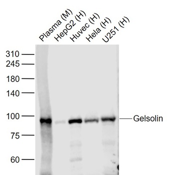 Gelsolin antibody