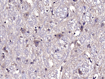 ATG13 Rabbit Polyclonal Antibody