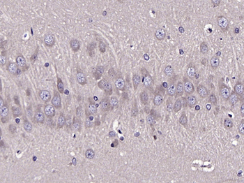 ATG13 Rabbit Polyclonal Antibody