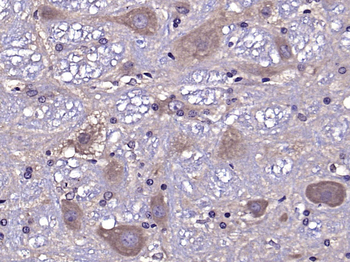 ATG13 Rabbit Polyclonal Antibody