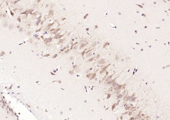 CaIPLA2 antibody