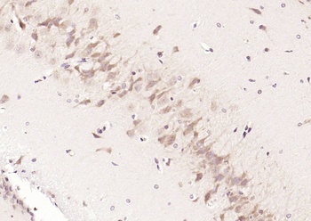 CaIPLA2 Rabbit Polyclonal Antibody
