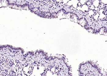 SIK1 Rabbit Polyclonal Antibody