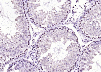 SIK1 Rabbit Polyclonal Antibody