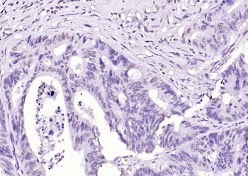 SIK1 Rabbit Polyclonal Antibody