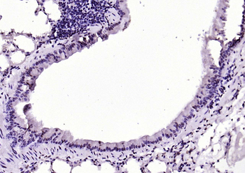 SIK1 Rabbit Polyclonal Antibody
