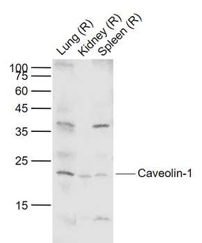 Caveolin-1 Rabbit Polyclonal Antibody