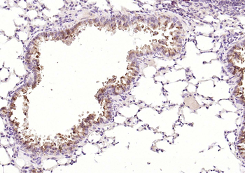 CATSPER Rabbit Polyclonal Antibody
