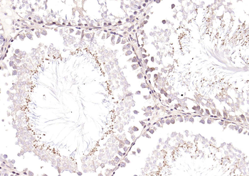 CATSPER Rabbit Polyclonal Antibody