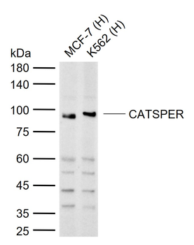 CATSPER Rabbit Polyclonal Antibody