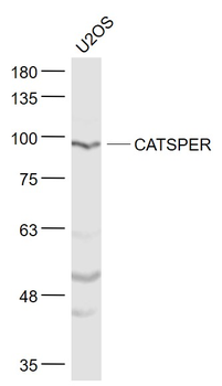 CATSPER Rabbit Polyclonal Antibody