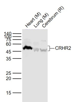 CRHR2 Rabbit Polyclonal Antibody