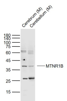MTNR1B Rabbit Polyclonal Antibody