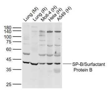 SP-B/Surfactant Protein B Rabbit Polyclonal Antibody