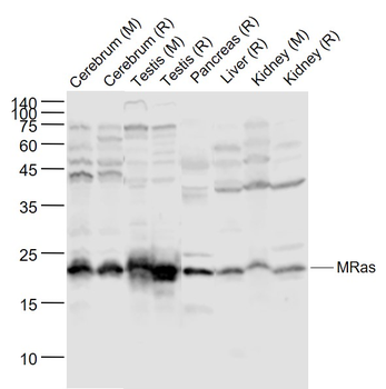 MRas Rabbit Polyclonal Antibody