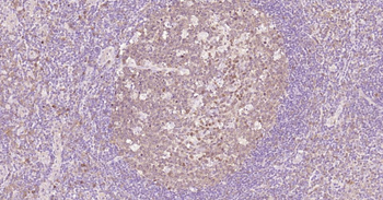 Caspase-3 Recombinant Rabbit Monoclonal Antibody