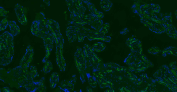 CD34 Recombinant Rabbit Monoclonal Antibody