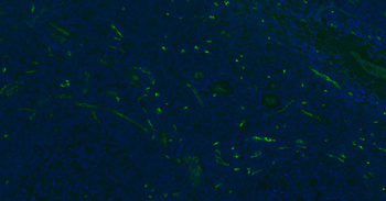 CD34 Recombinant Rabbit Monoclonal Antibody