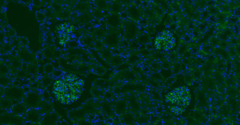 CD34 Recombinant Rabbit Monoclonal Antibody
