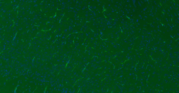 CD34 Recombinant Rabbit Monoclonal Antibody