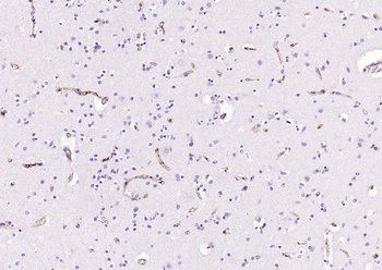 CD34 Recombinant Rabbit Monoclonal Antibody
