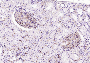 CD34 Recombinant Rabbit Monoclonal Antibody