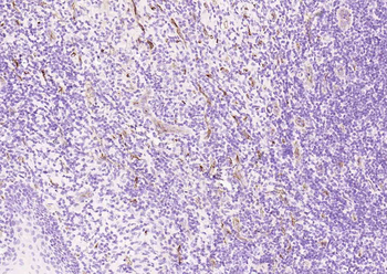 CD34 Recombinant Rabbit Monoclonal Antibody