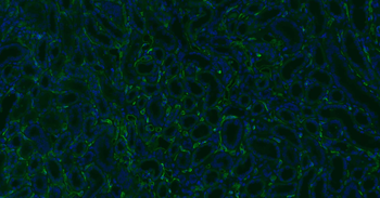CD34 Recombinant Rabbit Monoclonal Antibody