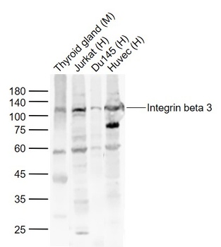 Integrin Beta 3 antibody