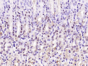 PAK5 Rabbit Polyclonal Antibody