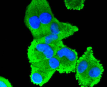 Cyclooxygenase 2 Recombinant Rabbit Monoclonal Antibody