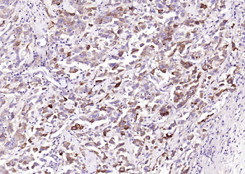 Cyclooxygenase 2 Recombinant Rabbit Monoclonal Antibody