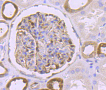 BST2 Recombinant Rabbit Monoclonal Antibody