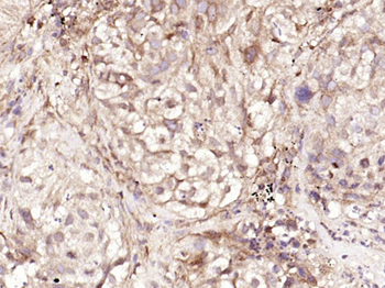 CALB2 Recombinant Rabbit Monoclonal Antibody