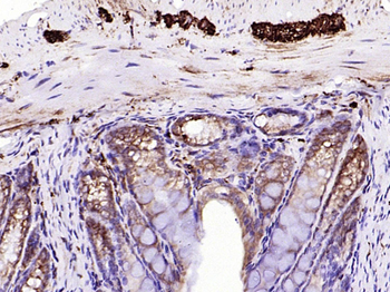 CALB2 Recombinant Rabbit Monoclonal Antibody