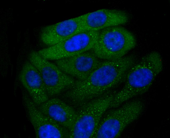 CXCR3 Recombinant Rabbit Monoclonal Antibody
