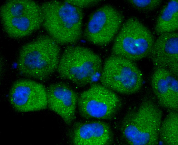 CXCR3 Recombinant Rabbit Monoclonal Antibody
