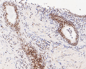 ATF4 Recombinant Rabbit Monoclonal Antibody