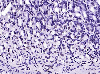 Lamin B1 Recombinant Rabbit Monoclonal Antibody