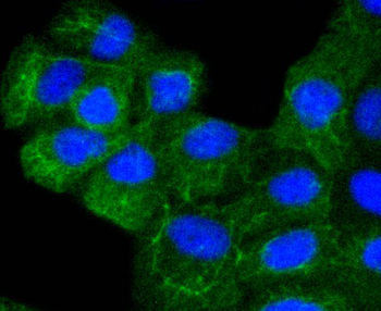 Cytokeratin 8 Recombinant Rabbit Monoclonal Antibody