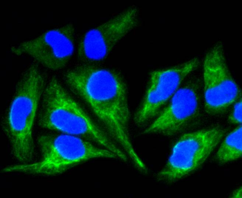 Cytokeratin 8 Recombinant Rabbit Monoclonal Antibody